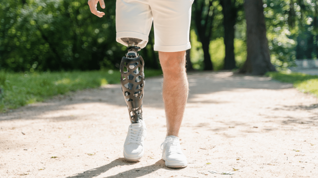 EMG Sensor-controlled prosthetics system using Raspberry Pi for movement detection